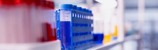 Standard versus Instant-SCBI for Steam Sterilization